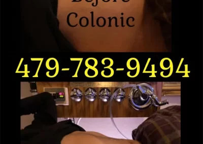 Expert Intestinal Cleansing