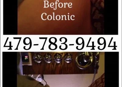 Professional Constipation Relief Service