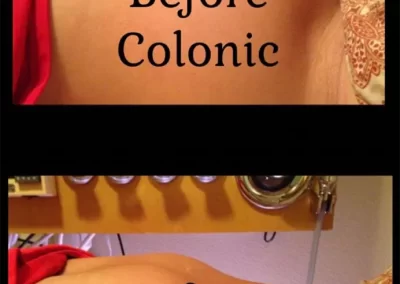 Proven Ibs Relief