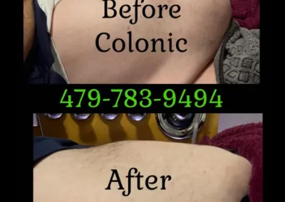 Quality Colonic Therapy